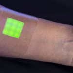 smart-bandage