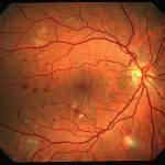 retina-scan
